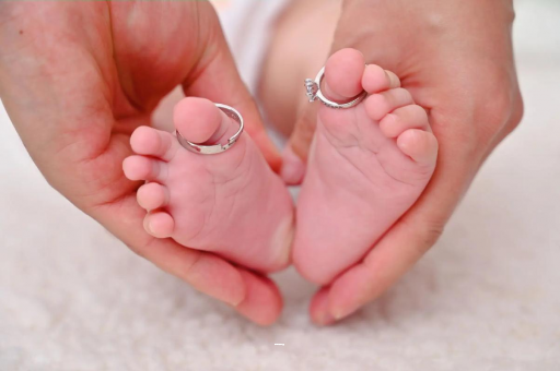 鹤壁孕妇怎样预防妊娠纹